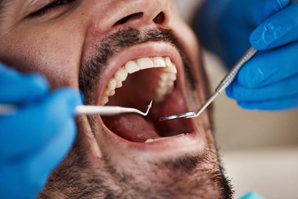 Best Broken Tooth Emergency  in Seville, OH
